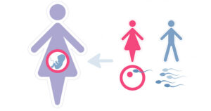 Гестаційне сурогатне материнство